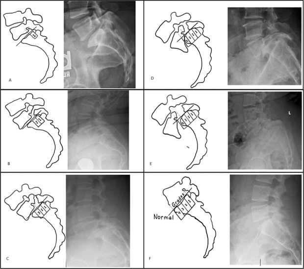 Fig. 1-