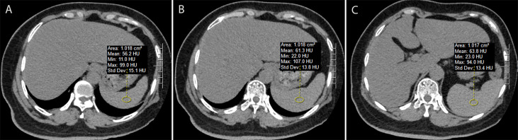 Figure 2