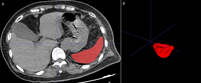 Figure 1