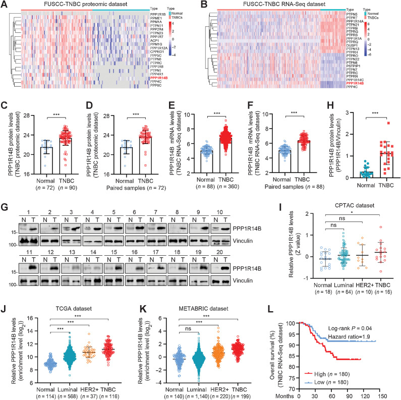 Figure 1. PPP1R14B is highly expressed in TNBC and predicts poor OS. A and B, Dysregulated PPPs in the FUSCC-TNBC proteomic (A) and FUSCC-TNBC RNA-seq databases (B), respectively. C and D, Protein levels of PPP1R14B in 90 TNBC tissues and 72 adjacent normal tissues in the FUSCC-TNBC proteomic database. Y-axis represents the relative abundance of proteins. E and F, mRNA levels of PPP1R14B in 360 TNBC tissues and 88 adjacent normal tissues in the FUSCC-TNBC RNA-seq database. Y-axis represents the log2(FPKM+1). FPKM, fragments per kilobase of transcript per million mapped reads. G and H, Immunoblotting analysis of PPP1R14B protein expression levels in 20 pairs of TNBC tissues and matched normal breast tissues. The gray intensity was quantified using ImageJ software. Quantitative results of relative PPP1R14B protein expression levels are shown in H. N, normal; T, tumor. I, Expression levels of PPP1R14B protein in the CPTAC database with different breast cancer subtypes. J, Analysis of PPP1R14B mRNA levels in TCGA database with different breast cancer subtypes. K, Analysis of PPP1R14B mRNA levels in the METABRIC (Molecular Taxonomy of Breast Cancer International Consortium) database with different breast cancer subtypes. L, Kaplan–Meier analysis of the OS of TNBC patients with high (n = 180) and low (n = 180) PPP1R14B expression.