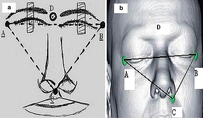 Fig. 3