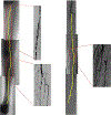 Fig 5.6.