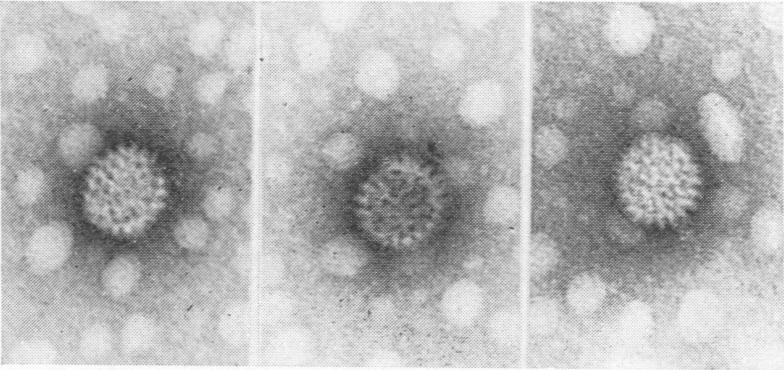 Fig. 2D, E and F.