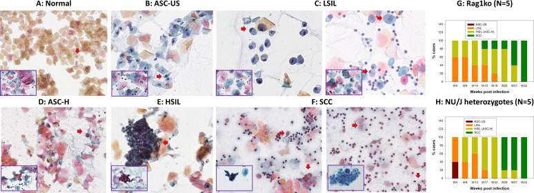 Pap smear micrographs feature normal cells, ASC-US, LSIL, ASC-H, HSIL, and SCC. Graphs feature the percent of cases for Rag1ko and NU J with the different cells across weeks postinfection.