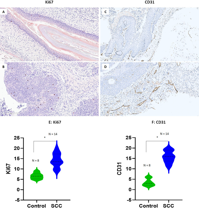 Micrographs feature normal vaginal tissue, low Ki67 CD31, and SCC tissue, high Ki67 CD31 from both mouse strains. Graphs quantify Ki67 CD31 levels in normal versus SCC, showing a significant increase in SCC.