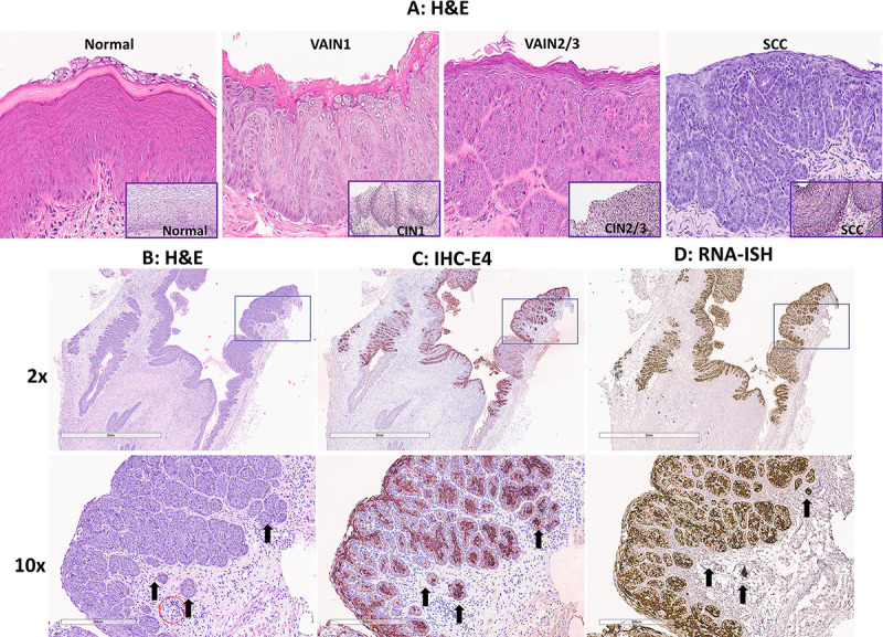 Micrographs feature human CIN tissue, mouse SCC, mouse SCC stained for viral E4 protein, and mouse SCC stained for viral RNA transcripts, with arrows indicating abundant RNA.