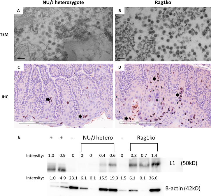 TEM micrographs of NU J and Rag1ko feature viral particles, with more particles for Rag. IHC micrographs of NU J and Rag1ko feature MmuPV1 L1 capsid protein higher in Rag1ko, and Western Blot features a band stronger in Rag1ko.