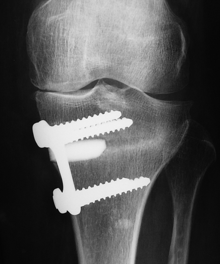 Fig. 5