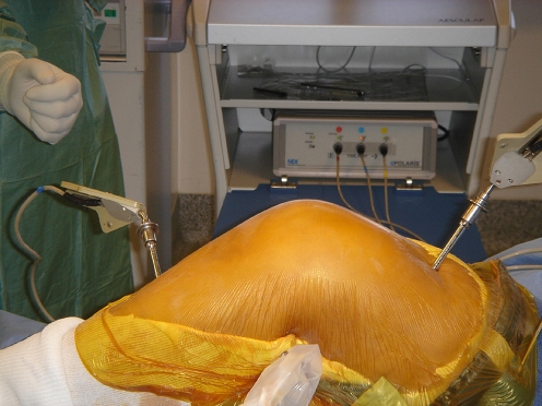 Fig. 4