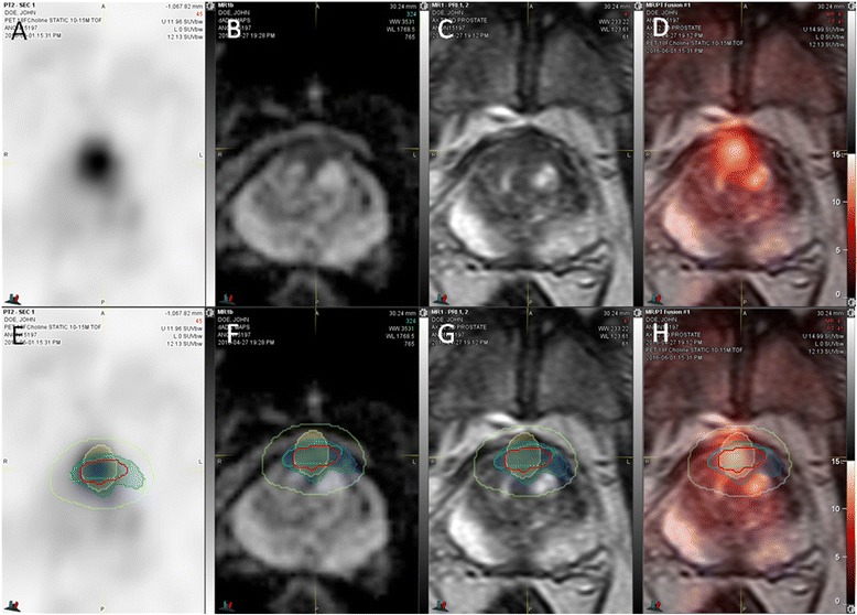 Fig. 5
