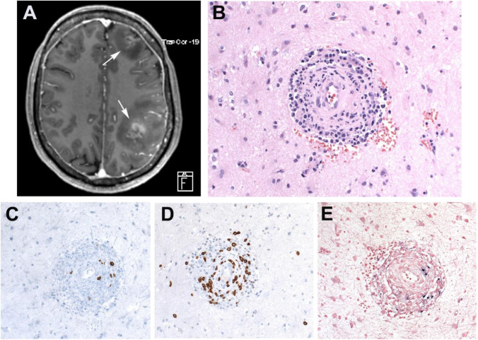 Fig. 4