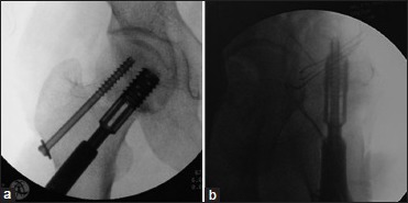 Figure 3B