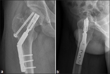 Figure 3C