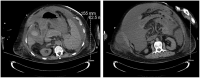 Image 2 and 3.