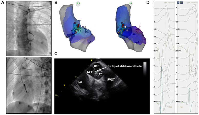 FIGURE 3