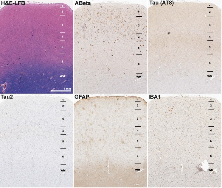 Figure 1—figure supplement 1.