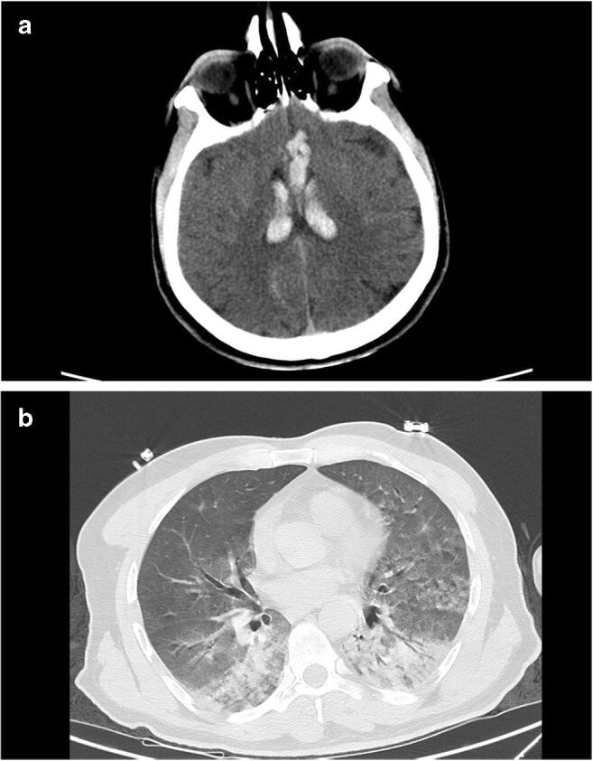 Fig. 1