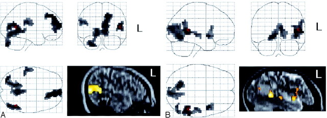 Fig 2.