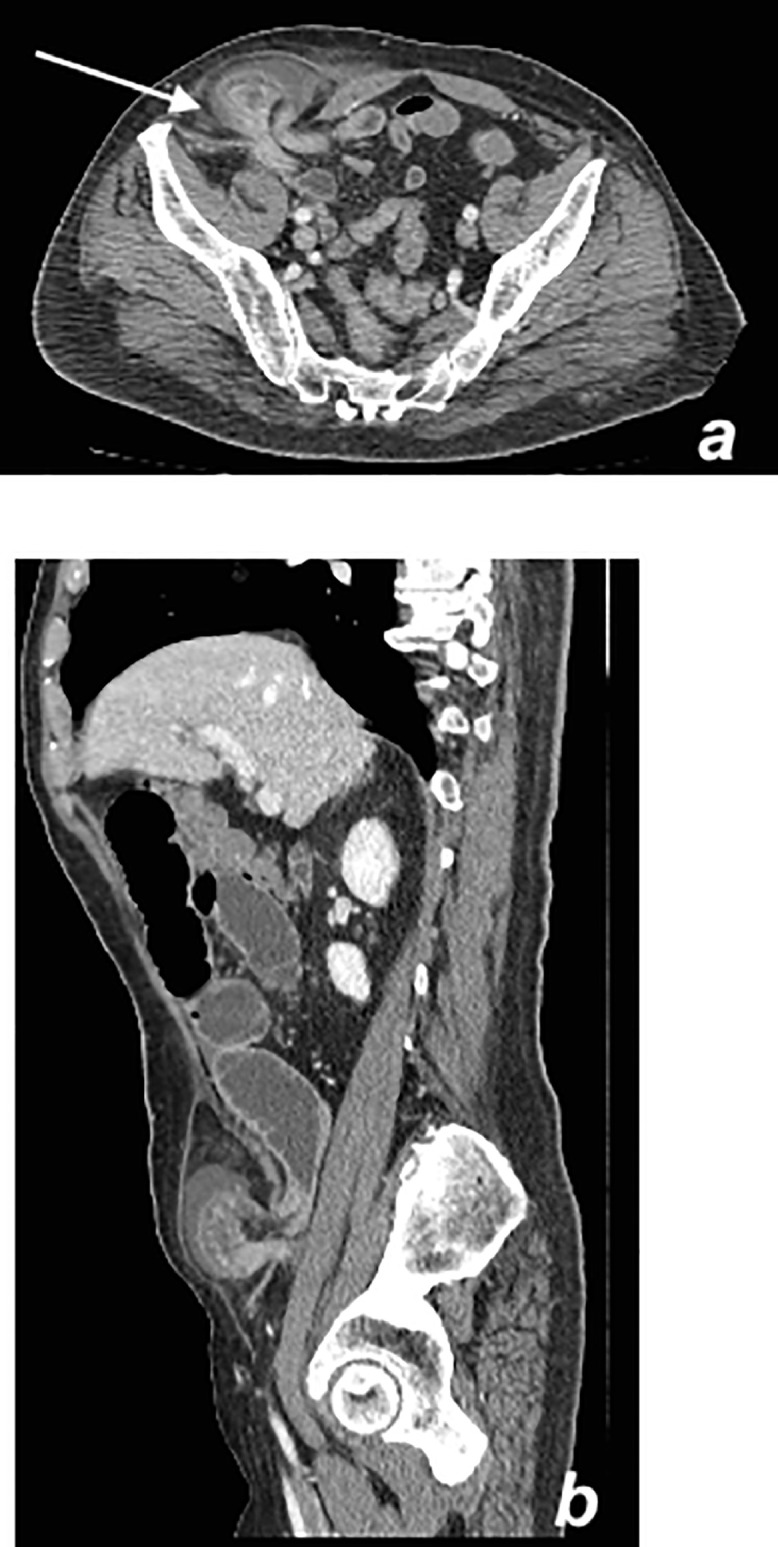 Fig. 3 –