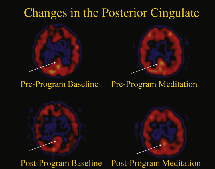 Fig.4