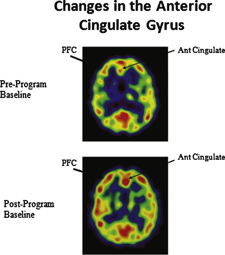 Fig.6