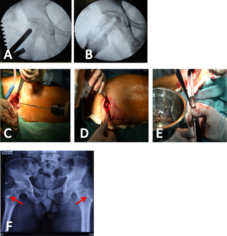 Figure 2