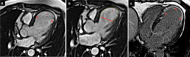 Supplementary Figure 1