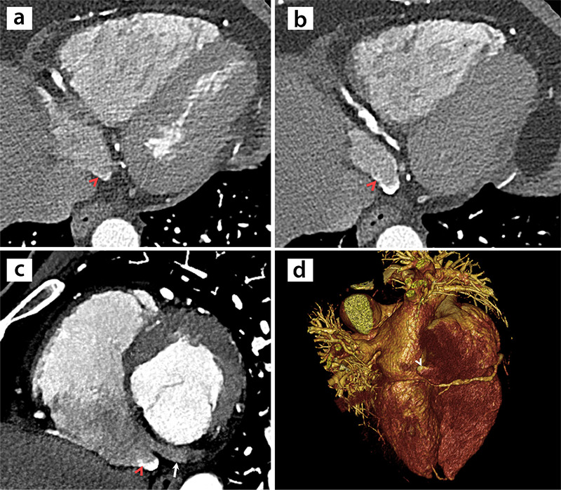 Figure 15