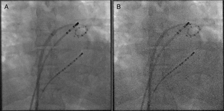 Figure 1