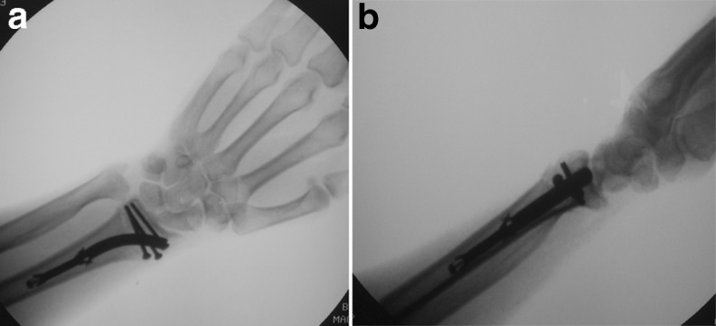 Fig. 2