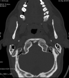 Fig. 3