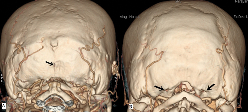 Fig. 5