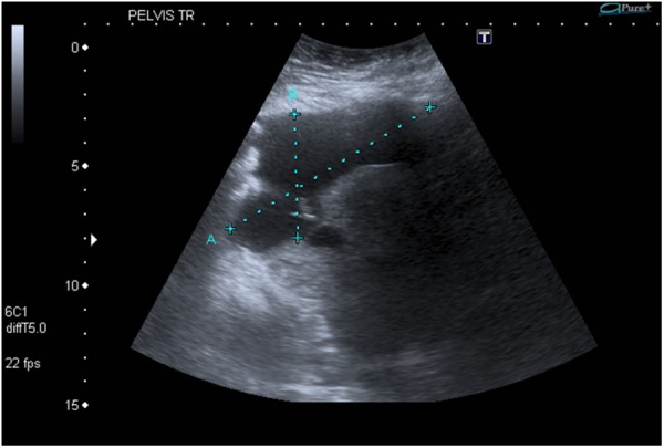 Figure 2