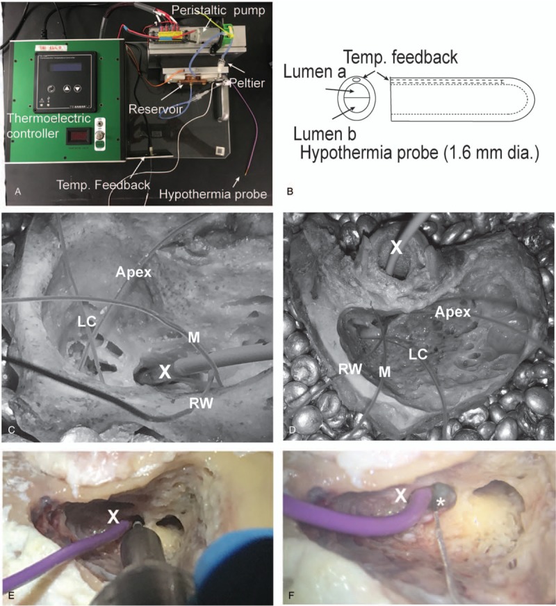 FIG. 3