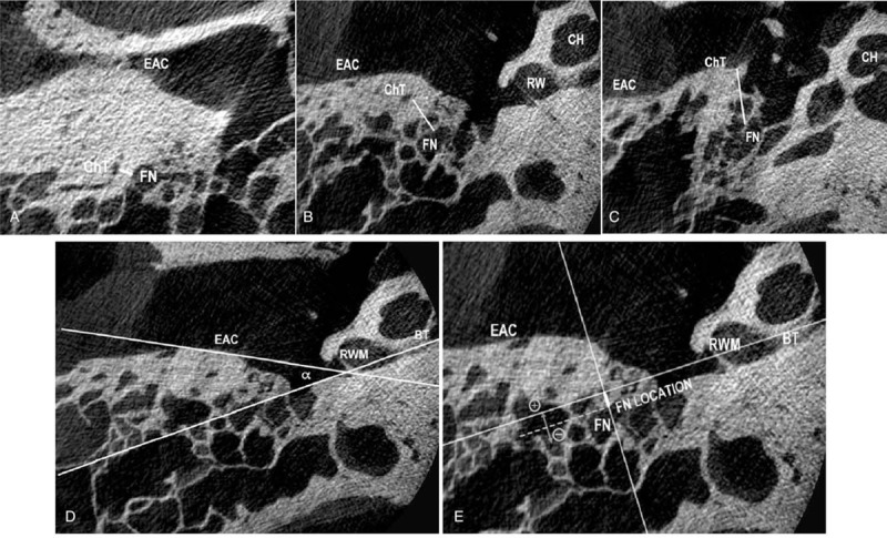 FIG. 1