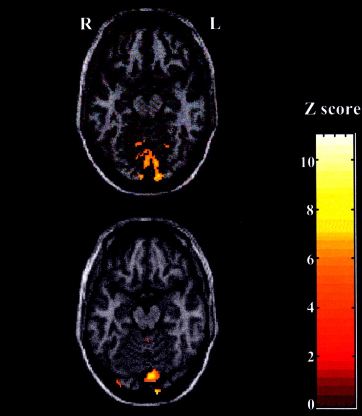 Fig 2.