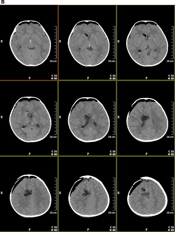 Fig. 1