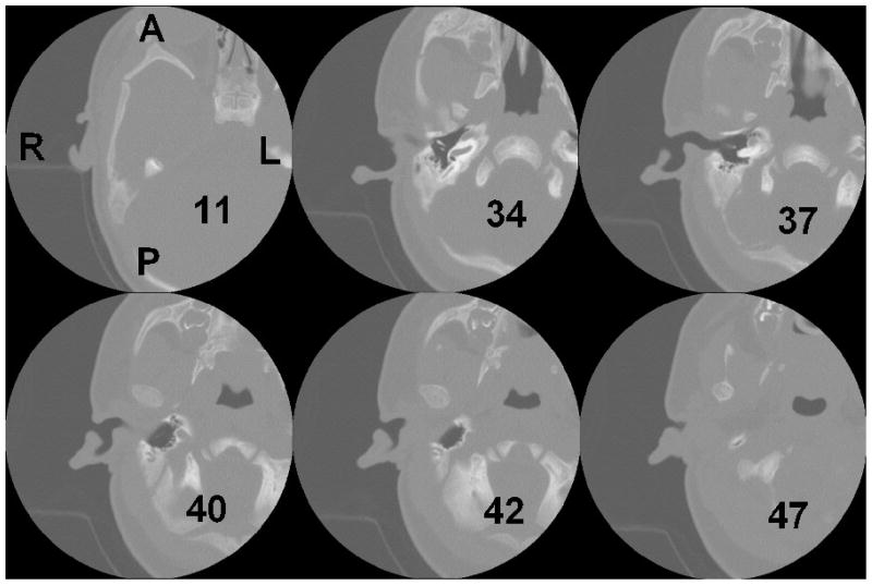 FIG. 1