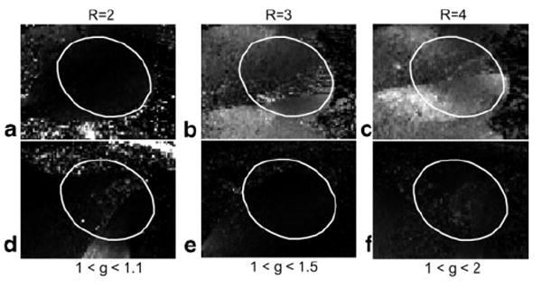 FIG.10