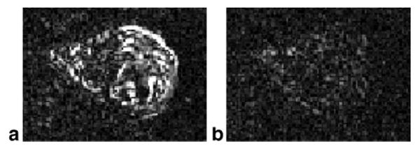 FIG. 11