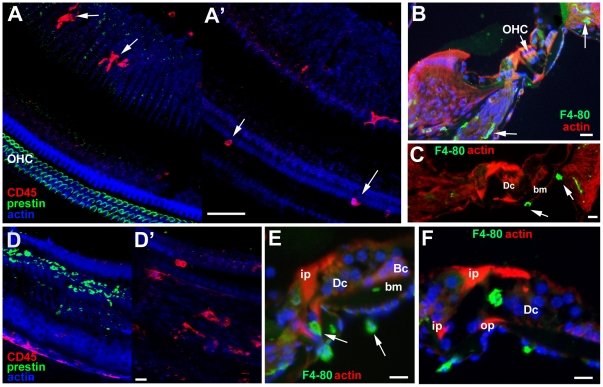 Figure 13