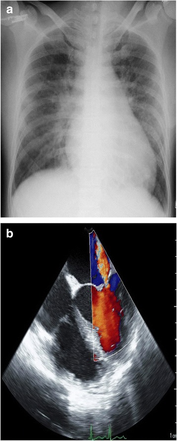 Fig. 2