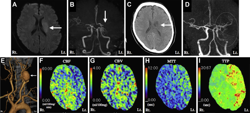 Fig 1