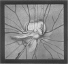 194