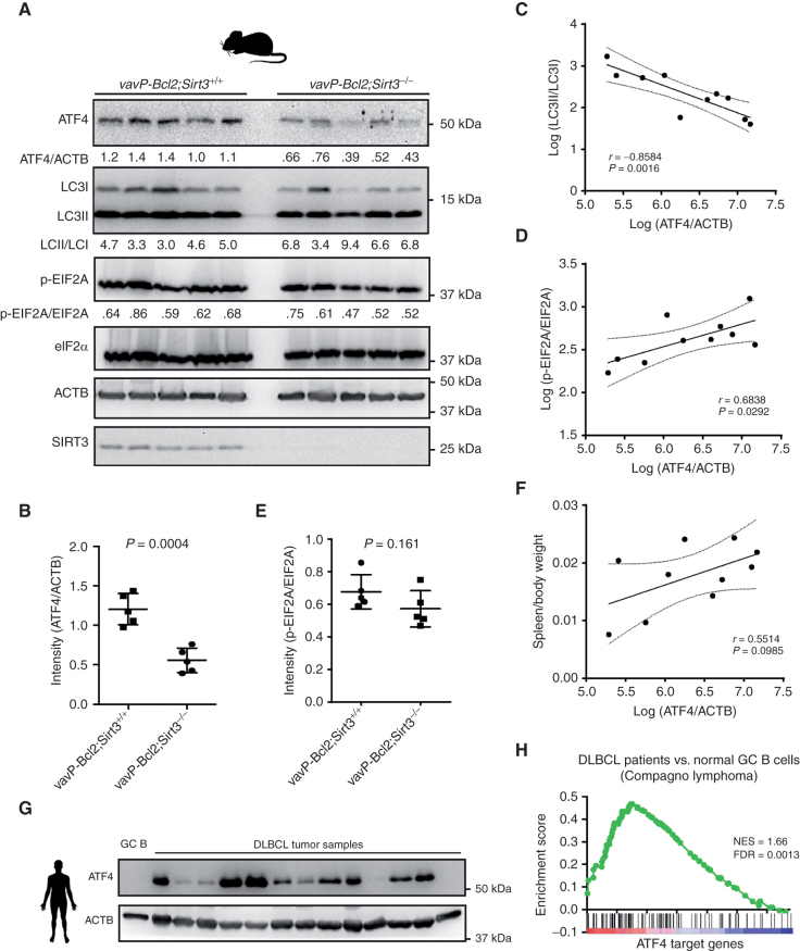 Figure 4. ATF4 protein level is decreased in vavP-Bcl2;Sirt3−/− mice and associated with lymphoma progression. A, Western blot results show the protein levels of ATF4, LC3, EIF2A, ACTB, and SIRT3 in splenocytes from vavP-Bcl2;Sirt3+/+ and vavP-Bcl2;Sirt3−/− mice. The protein amounts were quantified with densitometry results. B, Summarized results of ATF4 protein level normalized to ACTB in splenocytes from vavP-Bcl2;Sirt3+/+ and vavP-Bcl2;Sirt3−/− mice. The protein amounts were quantified with densitometry results from Western blots. C, Correlation between levels of autophagy (LC3II/LC3I) and ATF4 (ATF4/ACTB) in splenocytes from vavP-Bcl2;Sirt3+/+ and vavP-Bcl2;Sirt3−/− mice. The data for correlation study were obtained with densitometry results from Western blots. D, Correlation between levels of phospho-EIF2A (p-EIF2A/EIF2A) and ATF4 (ATF4/ACTB) in splenocytes from vavP-Bcl2;Sirt3+/+ and vavP-Bcl2;Sirt3−/− mice. The data for correlation study were obtained with densitometry results from Western blots. E, Summarized results of phospho-EIF2A level normalized to total EIF2A in splenocytes from vavP-Bcl2;Sirt3+/+ and vavP-Bcl2;Sirt3−/− mice. The protein amounts were quantified with densitometry results from Western blots. F, Correlation between splenomegaly phenotype (spleen/body weight) and levels of ATF4 (ATF4/ACTB) in splenocytes from vavP-Bcl2;Sirt3+/+ and vavP-Bcl2;Sirt3−/− mice. ATF4 levels were quantified with densitometry results from Western blots. G, Western blot results show ATF4 levels from human DLBCL tumor samples or normal GC B cells from human tonsil. ACTB levels were used as loading control. H, GSEA shows the enrichment of ATF4 target genes in DLBCL tumors versus normal GC B cells. Gene expression data were from published microarray data (53). Error bars represent the mean ± SD of three or more replicates.