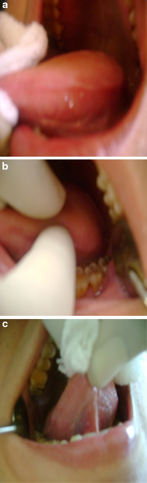 Fig. 1