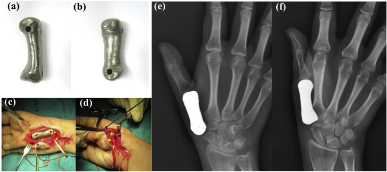 Fig. 6