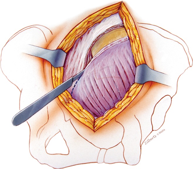 Fig. 2