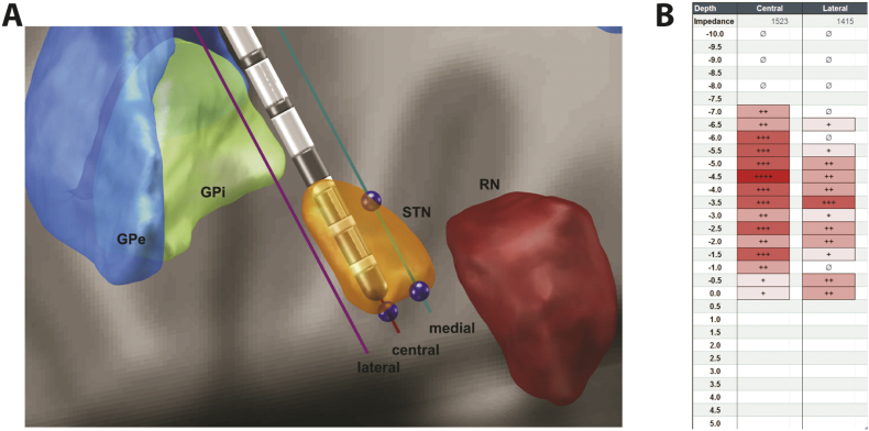 Fig. 1