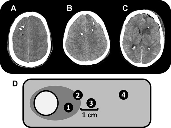 Fig. 1